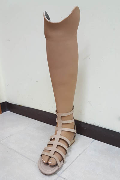 פרוטזה מתחת לברך עם ציפוי קוסמטי