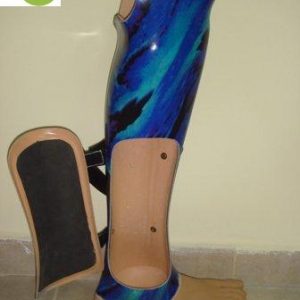 תותבת לרגל סיימס