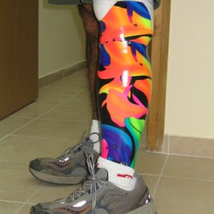 פרוטזה לרגל עם הדפס