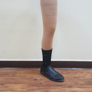 תותבת לרגל מעל הברך