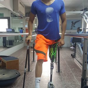 תותבת רגל מעל הברך