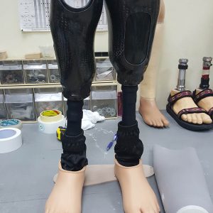 פרוטזות מקרבון