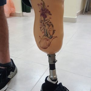 קעקוע לפרוטזה רגל