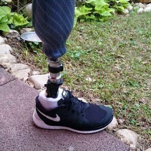 פרוטזה מתחת לברך כף רגל TRITON