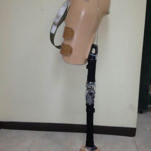 פרוטזה מעל הברך עם ברך מכנית נעולה