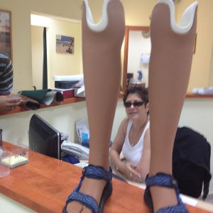 פרוטזות מתחת לברך עם כיסוי קוסמטי