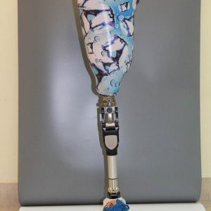 פרוטזה AK עם ברך TOTAL KNEE