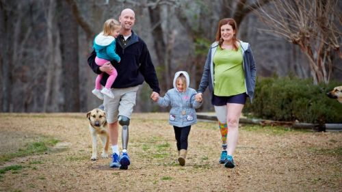 פרוטזה מתחת לברך